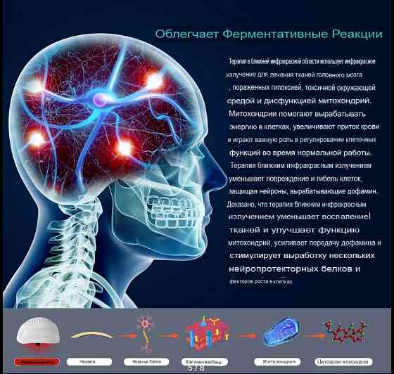 Лечение от Деменции, Паркинсона, Альцгеймера. Шлем Санкт-Петербург