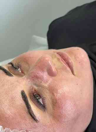 Жидкий лазер Таганрог