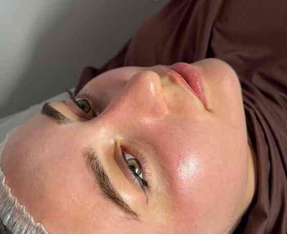 Жидкий лазер Таганрог