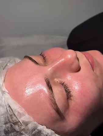 Жидкий лазер Таганрог