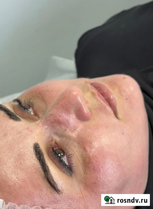 Жидкий лазер Таганрог - изображение 2