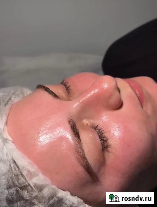 Жидкий лазер Таганрог - изображение 3